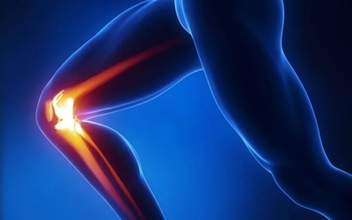 chirurgia protesica di ginocchio ad alta personalizzazione