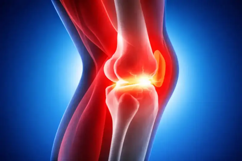 Trapianto della cartilagine del ginocchio