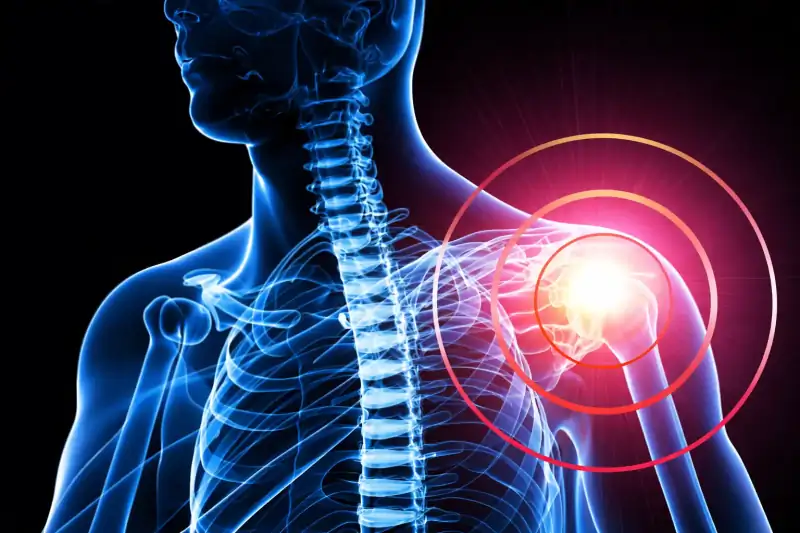 Chirurgia della spalla