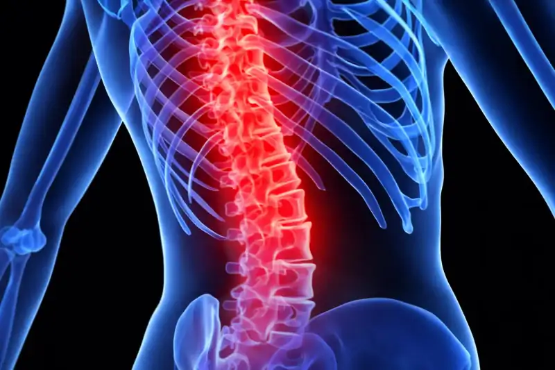 Ozonoterapia percutanea